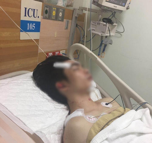 吴女士弟弟在ICU病房接受治疗(伤者家人吴女士提供)